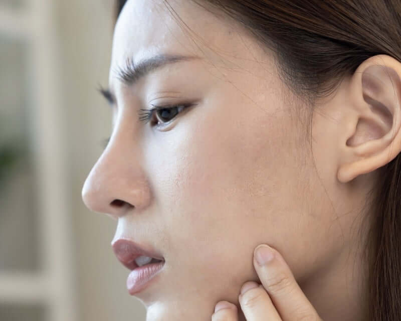 Dull skin